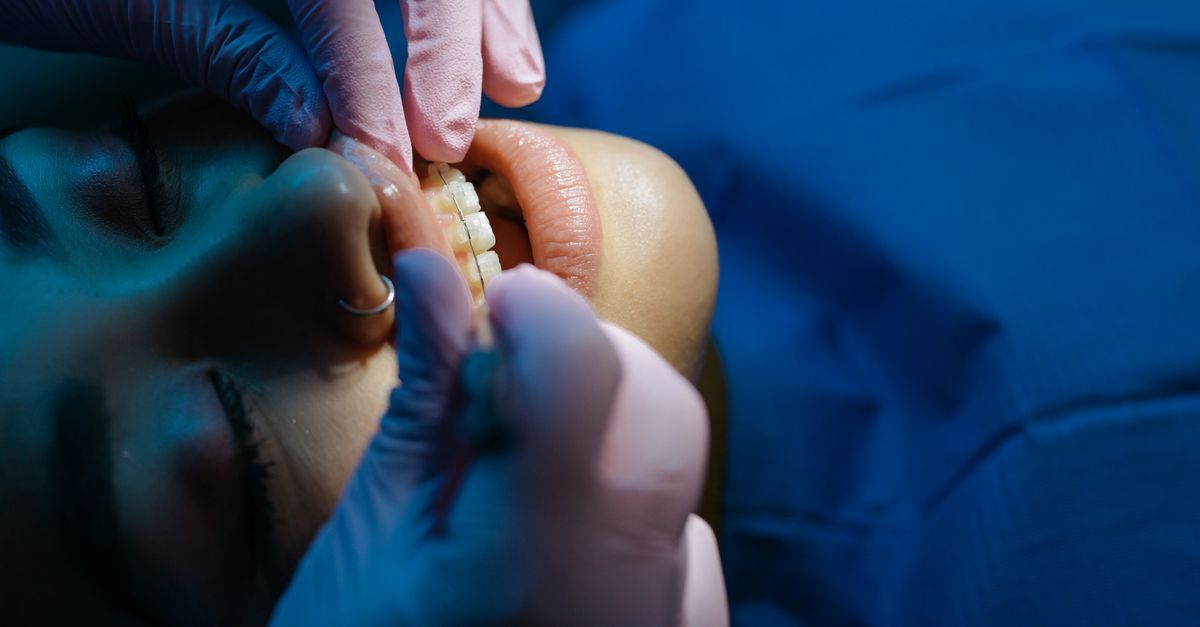Vantagens de tratar o sorriso com tecnologia invisível
